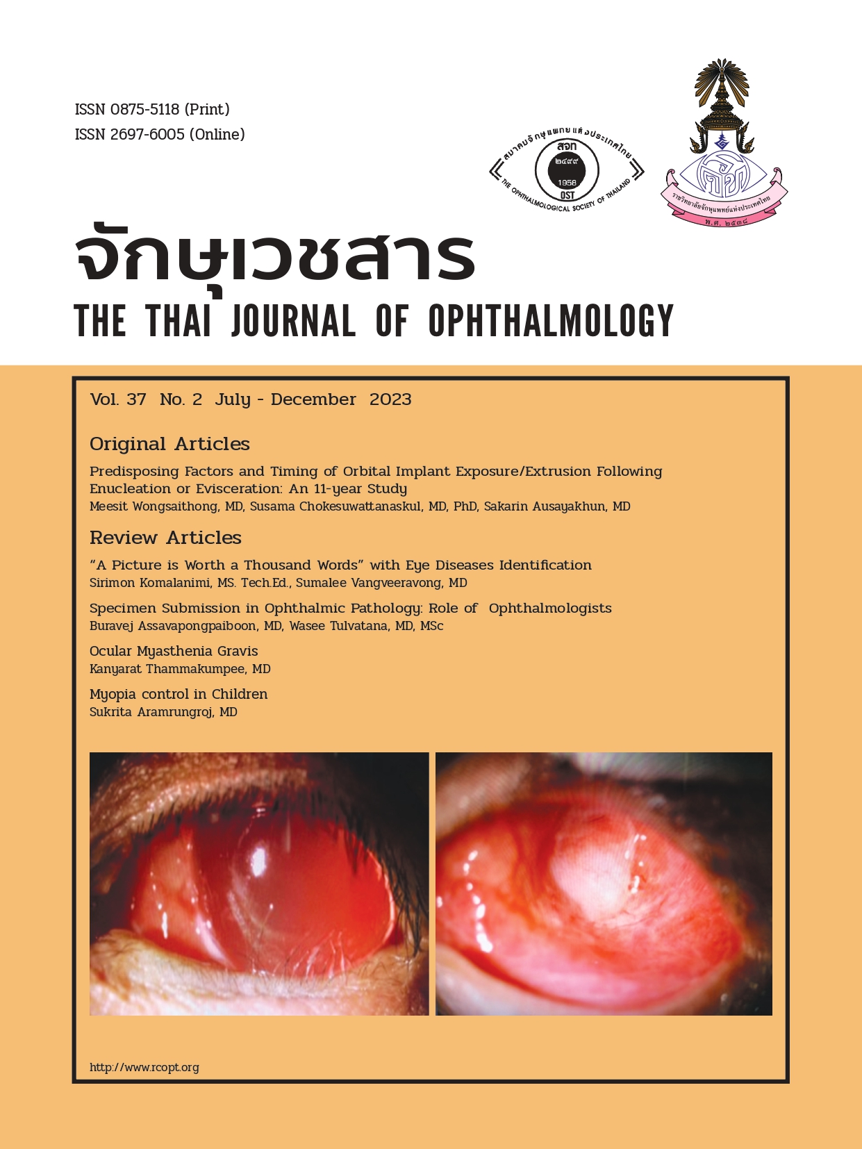 Cover J Ophthalmol-37-2-66-1_page-0001.jpg